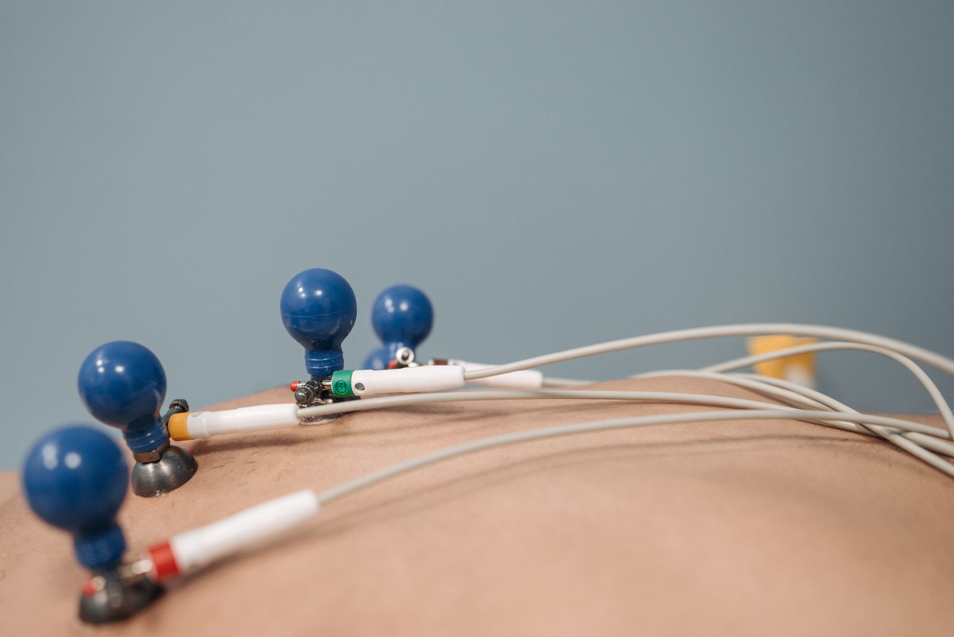 ECG examination with chest electrodes and lead wires